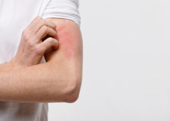 Plataforma virtual reúne história da Hanseníase no Brasil